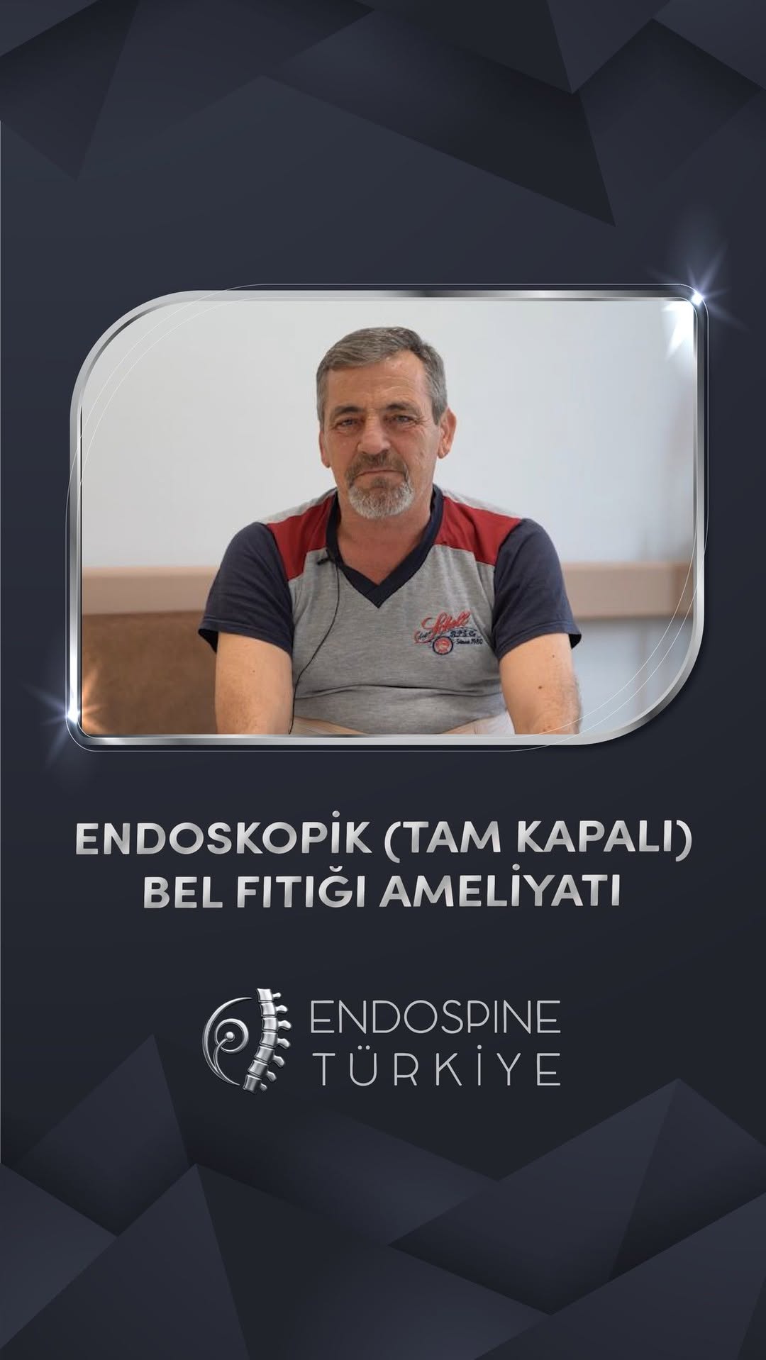 Nazif Ergen - Tam Kapalı Endoskopik Bel Fıtığı