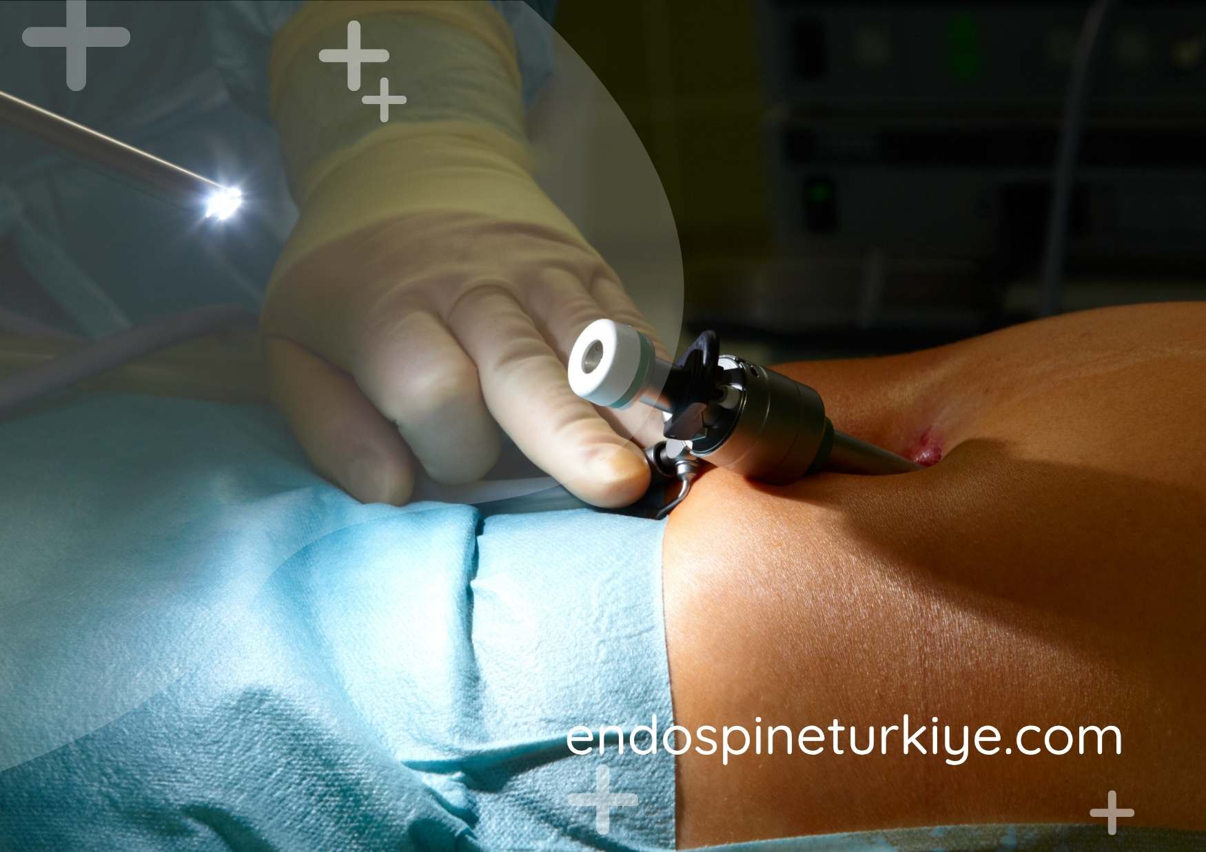 Minimal Kesi ile Fıtık Ameliyatı